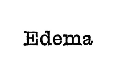 Beyaz zemin üzerinde bir daktilo kelime ödem