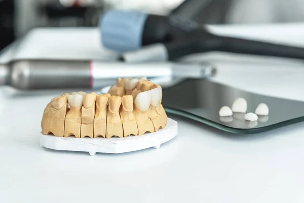 Artificial jaw with dental veneers and crowns in the dental laboratory.