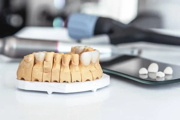 Artificial jaw with dental veneers and crowns in the office at the dentist.