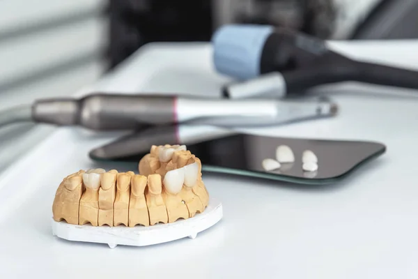 Mandíbula artificial con carillas y coronas dentales en el laboratorio dental . —  Fotos de Stock