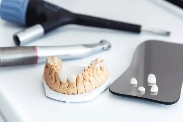 Diş laboratuvarında kaplama, Dental implantlar ve kron imalatı