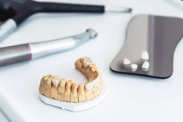 Artificial jaw with dental veneers and crowns in the dental laboratory.