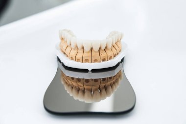 An artificial jaw with veneers and crowns, stands on a surgical glass in a stolmatologic office. Dentistry and treatment concept