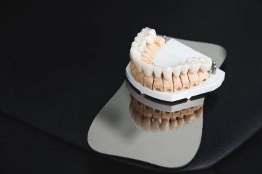 An artificial jaw with veneers and crowns, stands on a surgical glass in a stolmatologic office. Dentistry and treatment concept