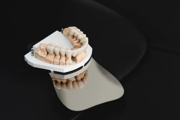Искусственная челюсть с циркониевыми коронками, стоит на хирургическом зеркале в стоматологическом кабинете. Концепция стоматологии и лечения — стоковое фото