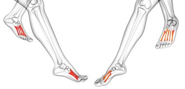 metatarsal 3D render çizimi