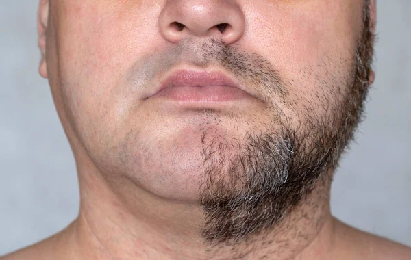 Lower Part Face Man Half Face Shaved Other Half Beard — Stock Photo, Image