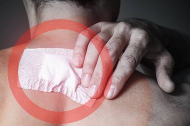 Fibroma alındıktan sonra bir adamın sırtına saplanmış bir yara, bir doğum lekesi. Yakından, tonlamalı