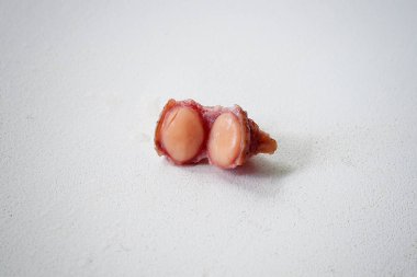 Fibroma, beyaz arka plandaki bir kesikte ben yakın plan.