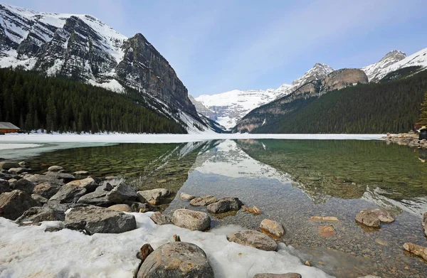 Louise Gölü Nde Manzara Banff Ulusal Parkı Alberta Kanada — Stok fotoğraf