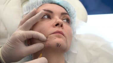 Beyaz eldivenli doktor çene şeklini düzeltiyor.