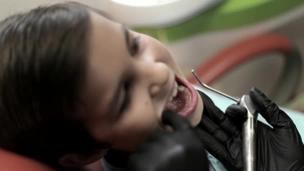 一个男孩去看牙医, 一个女医生对待孩子的牙齿。特写 — 图库视频影像