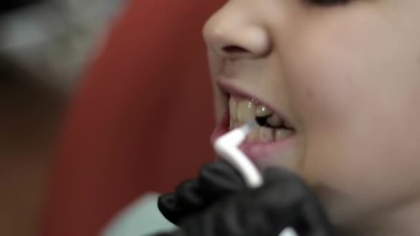 Хлопчик відвідує стоматолога, жінка-лікар лікує зуби дитини. крупним планом — стокове відео