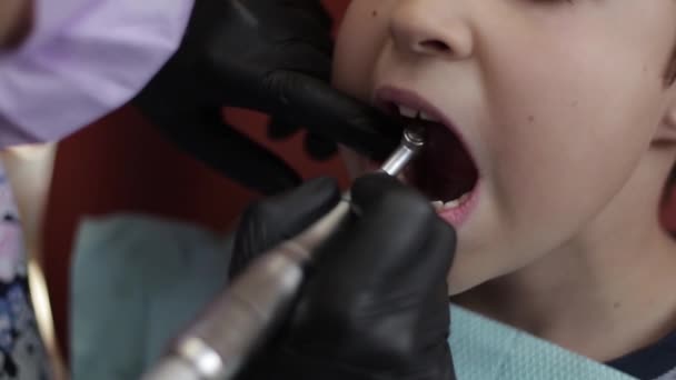 Ένα αγόρι επισκέπτεται τον οδοντίατρο, γυναίκα γιατρός μεταχειρίζεται childs δοντιών — Αρχείο Βίντεο