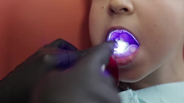 Menino no dentista sente-se na cadeira com uma boca aberta — Vídeo de Stock