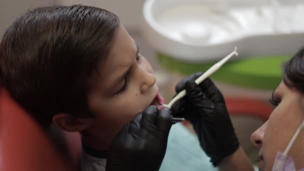 Niño en el dentista sentarse en la silla con la boca abierta — Vídeo de stock