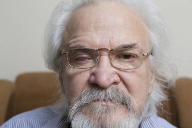 Göz hastalıkları bir yalnız hasta zavallı yaşlı adam acı bağımsız olarak muhafazakar katarakt ve Glokom tedavisinde nişanlı.