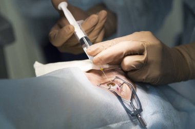 Lazer ameliyatı için vizyon düzeltme ve katarakt kaldırma