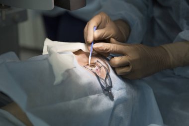 Lazer ameliyatı için vizyon düzeltme ve katarakt kaldırma