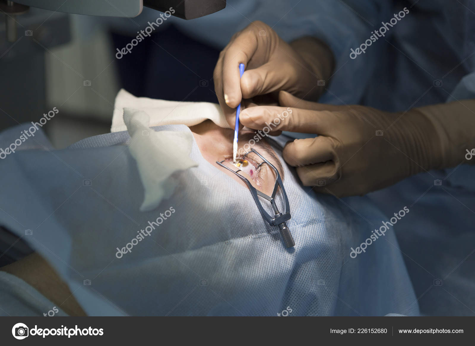 Laser Surgery Vision Correction Cataract Removal Stock Photo by