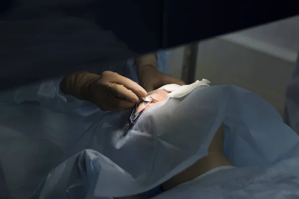 Laserowa Chirurgia Wizja Korekty Zaćma Usuwania — Zdjęcie stockowe