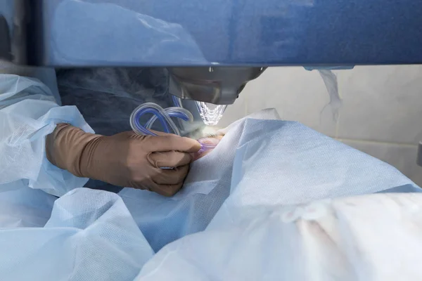 Operasi Laser Untuk Koreksi Penglihatan Dan Penghapusan Katarak — Stok Foto