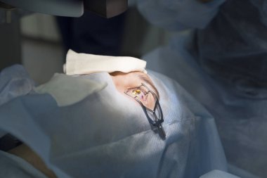 Lazer ameliyatı için vizyon düzeltme ve katarakt kaldırma