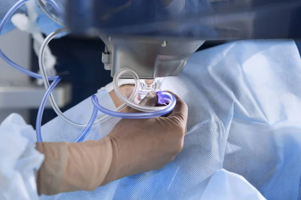 Operasi laser untuk memperbaiki penglihatan — Stok Foto