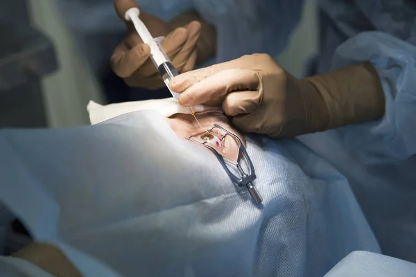 Laserkirurgi för synkorrigering — Stockfoto