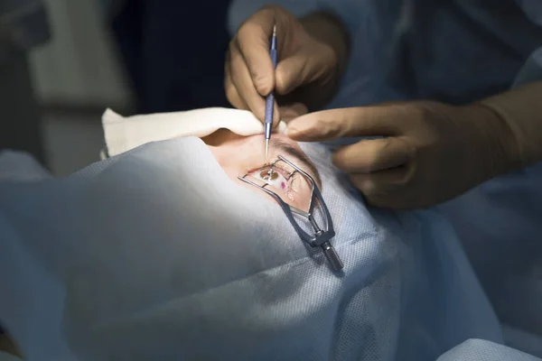 Χειρουργική επέμβαση για την διόρθωση της όρασης με laser — Φωτογραφία Αρχείου