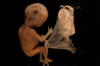 Human fetus at third month of pregnancy. Preserved in Formaldehyde. clipart