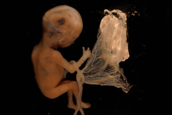 Ανθρώπινο Έμβρυο Στο Τρίτο Μήνα Της Εγκυμοσύνης Διατηρείται Φορμαλδεΰδη — Φωτογραφία Αρχείου
