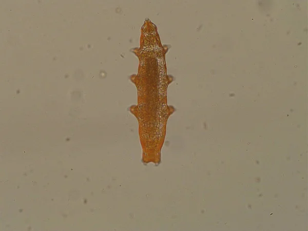 Oso de agua bajo el microscopio. 40 veces magnificado . —  Fotos de Stock