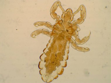 Mikroskop altında baş louse (Pediculus humanus capitis).