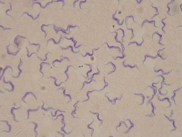 Krevní nátěr pacienta se spavou nemocí. Trypanosoma brucei. — Stock fotografie