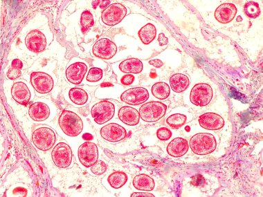 Mikroskop altında ekinoksik kist (400x). Echinococcus granulosus. Köpek bağırsak kurdu paraziti..