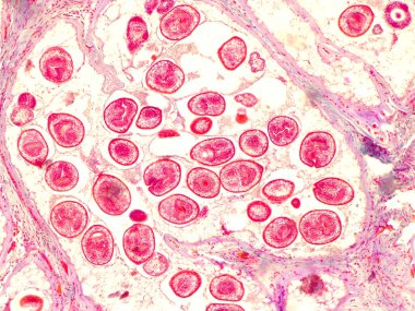 Echinococcal cyst under the microscope (400x). Echinococcus granulosus. Dog tapeworm parasite. clipart