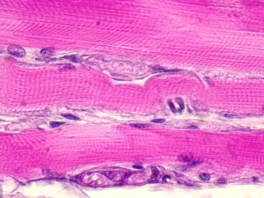 Skeletal striated muscle tissue under the microscope. clipart