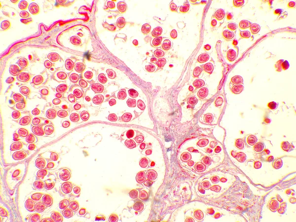 Torbiel hydatydowa pod mikroskopem (100x). Echinococcus granulosus. Pasożyt tasiemca psów. — Zdjęcie stockowe