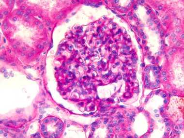 Microscopic photograph of a glomerulus in human kidney. clipart
