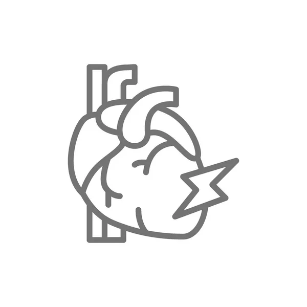 Vektor hjärtinfarkt, hjärtinfarkt linje ikon. — Stock vektor