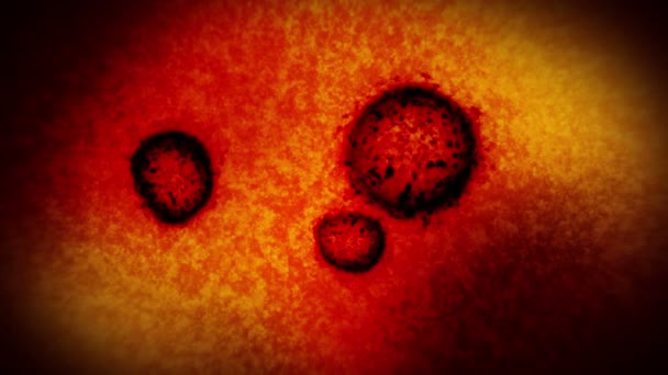 Virus Bacteriën Onder Microscoop Coronavirus Covid Influenza Sars Mers Microbiologie — Stockvideo