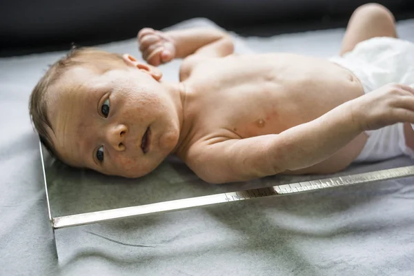 Nyfödd Pojke Med Många Finnar Vars Tillväxt Mäts — Stockfoto
