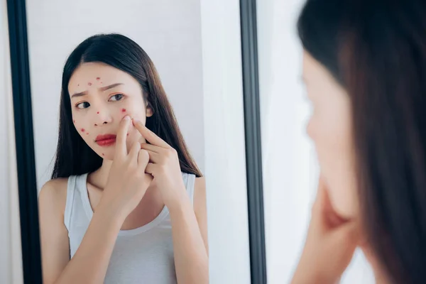 Joven Asiática Mujer Exprimir Acné Problema Cara Mirando Espejo Sin — Foto de Stock