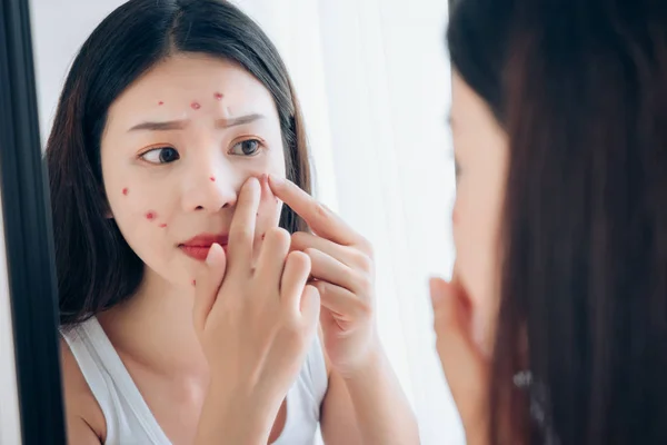 Young Asian Woman Squeeze Acne Problem Face Looking Mirror Her — Stock Photo, Image