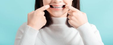 Diş teli takan, diş teli takan, beyaz dişli güzel gülümseyen, mavi arka planda sağlıklı, izole edilmiş stüdyo çekimlerinde kendine güveni artıran, web için panoramik boyutlarda bir kadın..