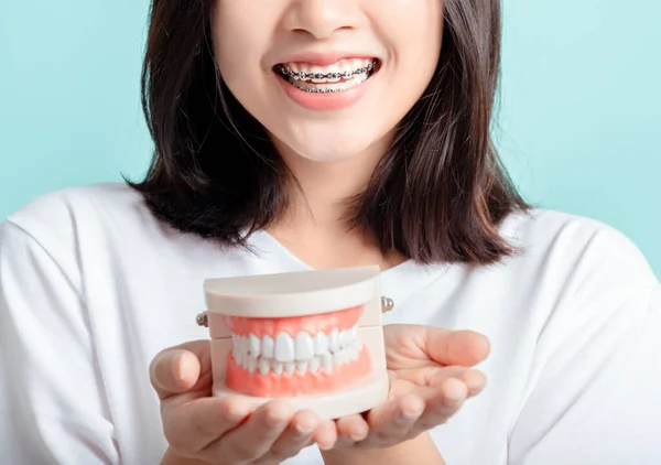 歯のサンプルと白い歯を持つブレースを身に着けているアジアの女性の歯のブレースは 青の背景に健康のための信頼性を増加させます孤立したスタジオショット 幸福ティーネージャー笑顔表情 — ストック写真