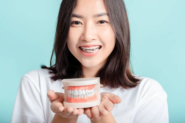 Aparelho Dentário Ásia Mulher Vestindo Aparelho Com Dente Amostra Branco — Fotografia de Stock