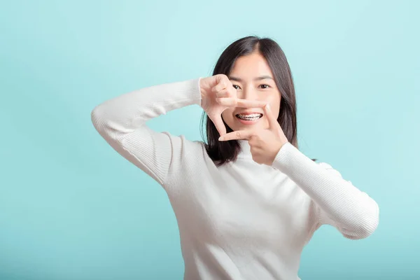 교정기 미모를 착용하고 치아를 이시아 여성의 교정기파란 스튜디오 건강에 자신감 — 스톡 사진