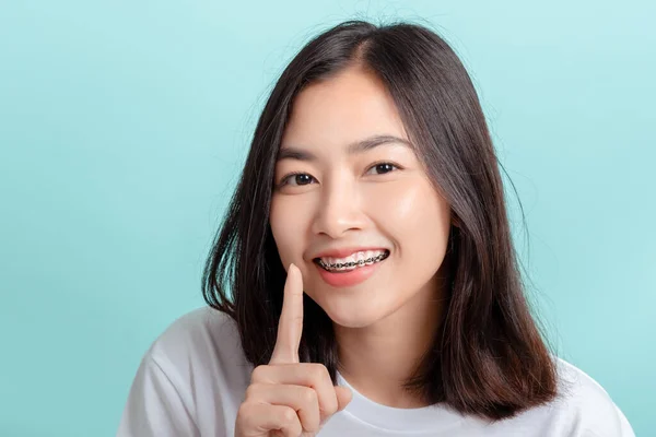 Tandbeugels Van Jonge Aziatische Vrouw Dragen Beugel Schoonheid Glimlach Met — Stockfoto